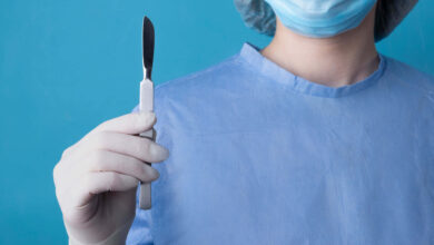 chirurgiczne usuwanie ginekomastii