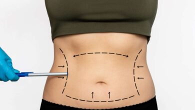 gojenie po liposukcji